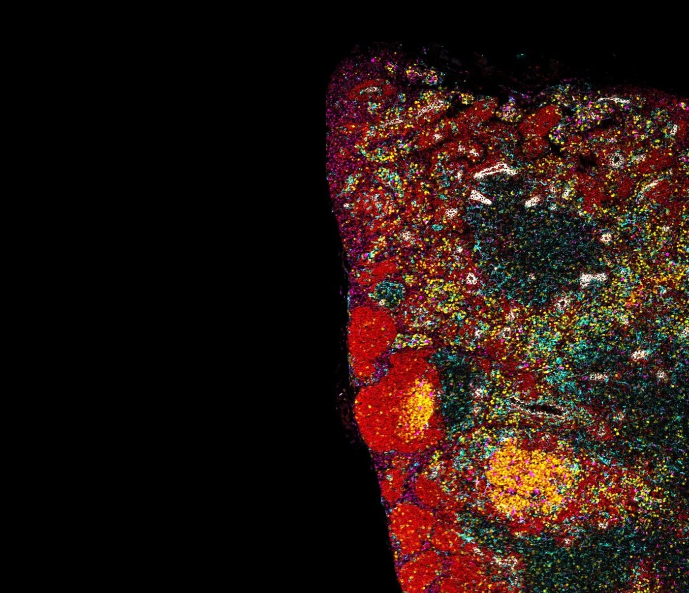 Multiplex immunofluorescence showing germinal centers within a tumor section